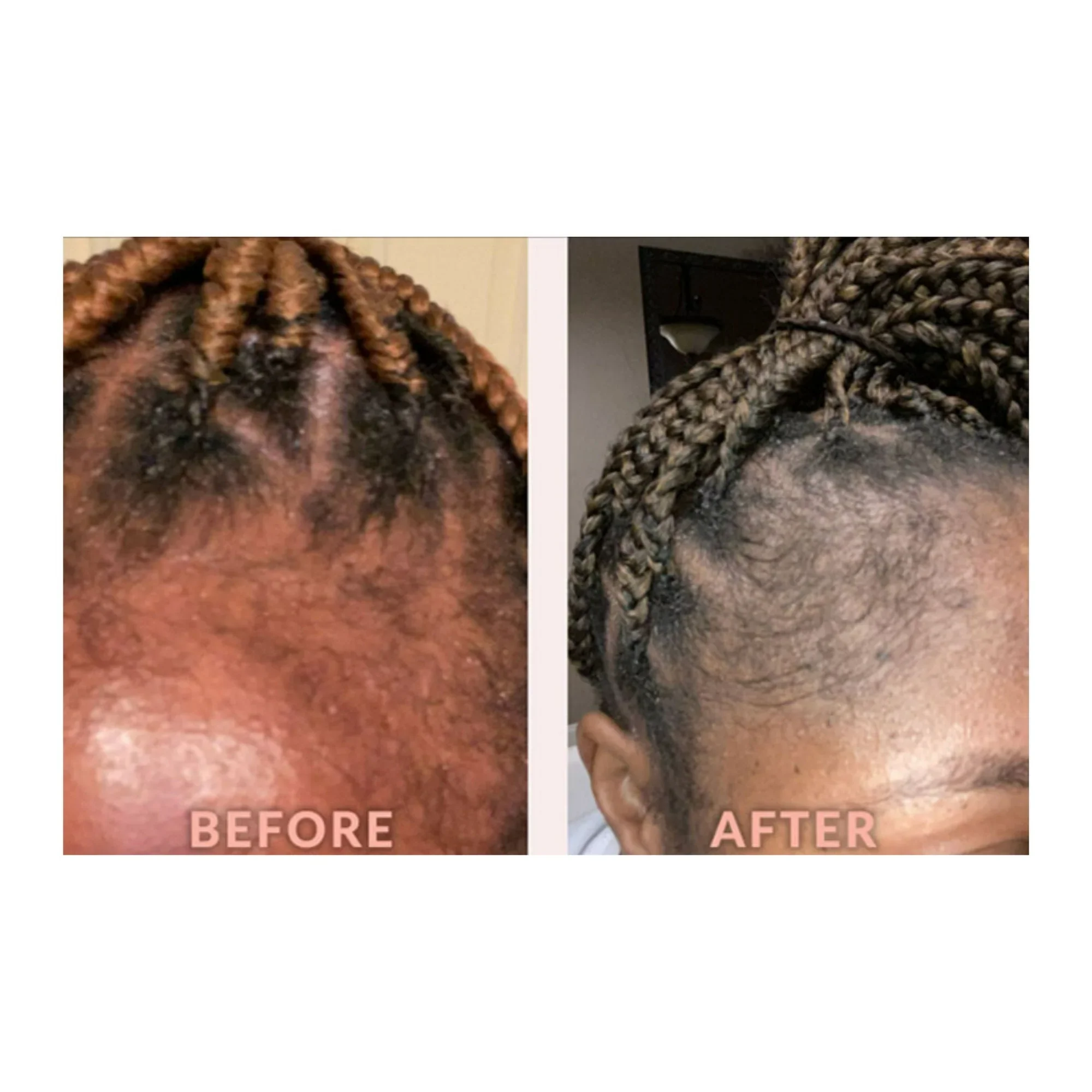 DESIGN EDGE & TEMPLE STRENGTHENING OIL  4 OZ (BIOTIN & BLACK CASTOR OIL)(DES00547) - Image 4